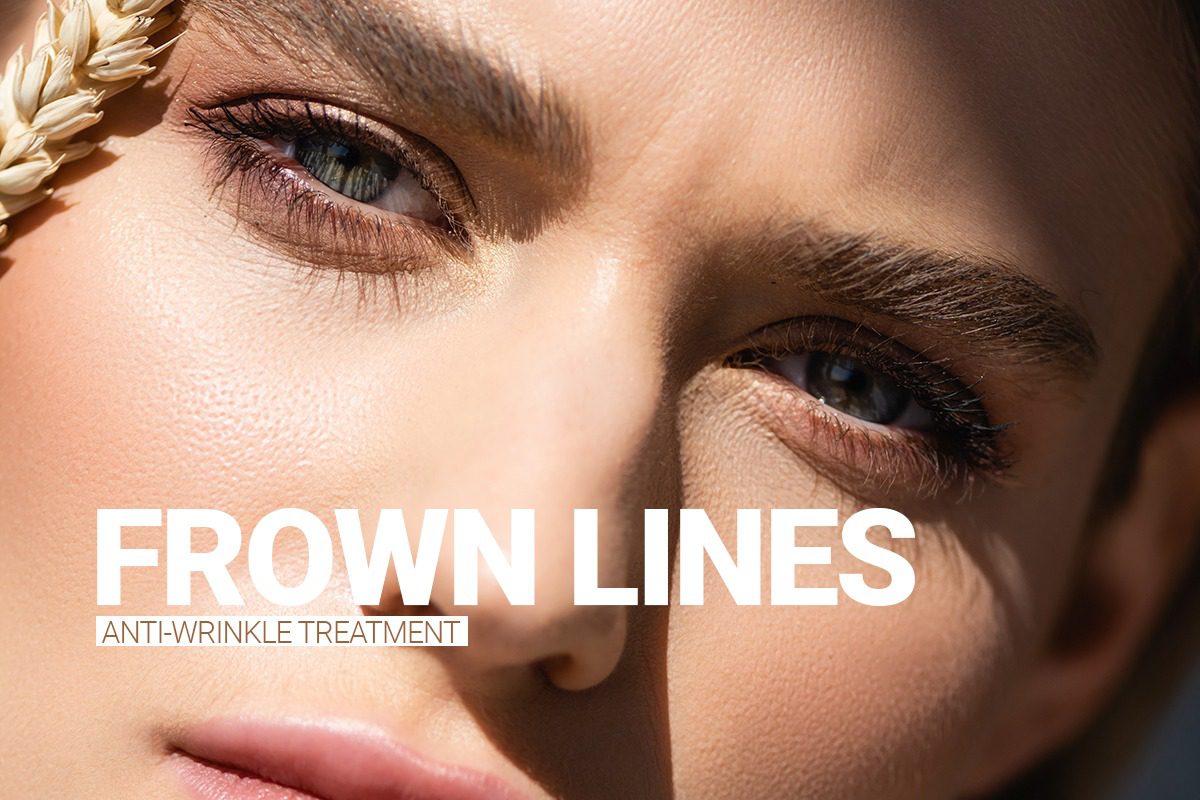 Frown Lines Treatment