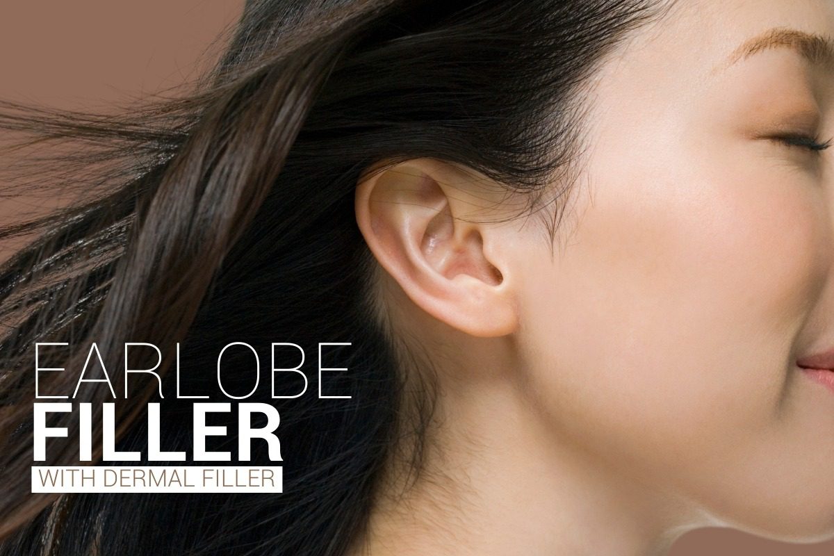 Ear Filler Treatment M1 Med Beauty Australia