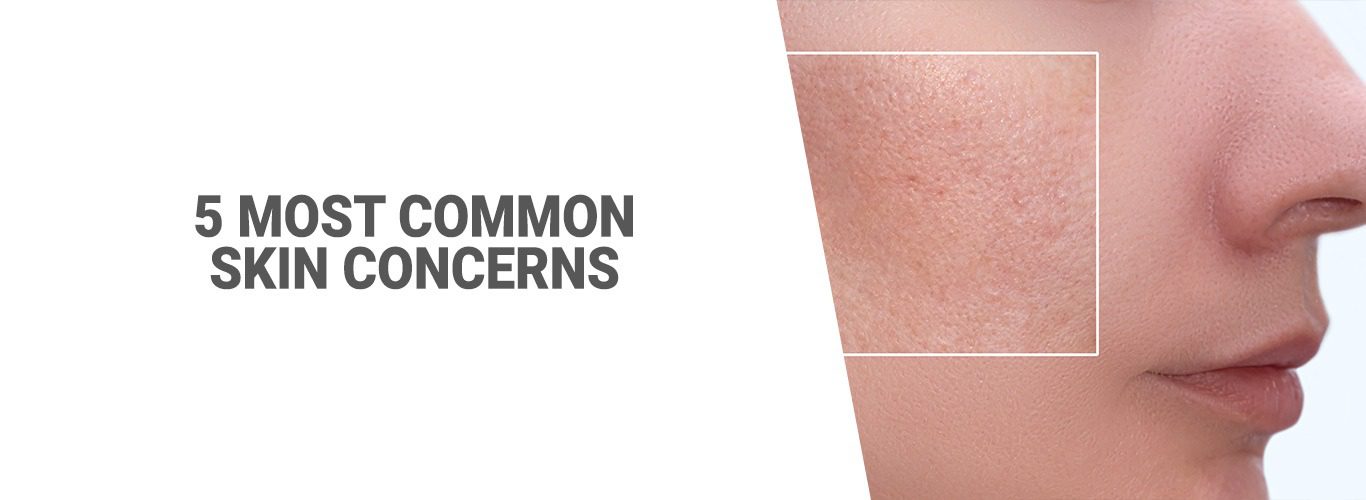 5 Most Common Skin Concerns