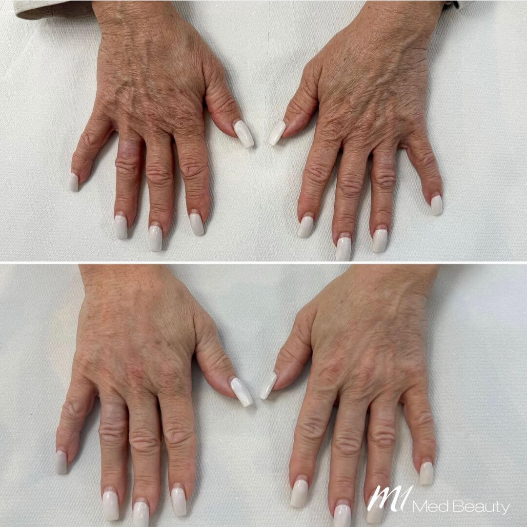Hands (1)