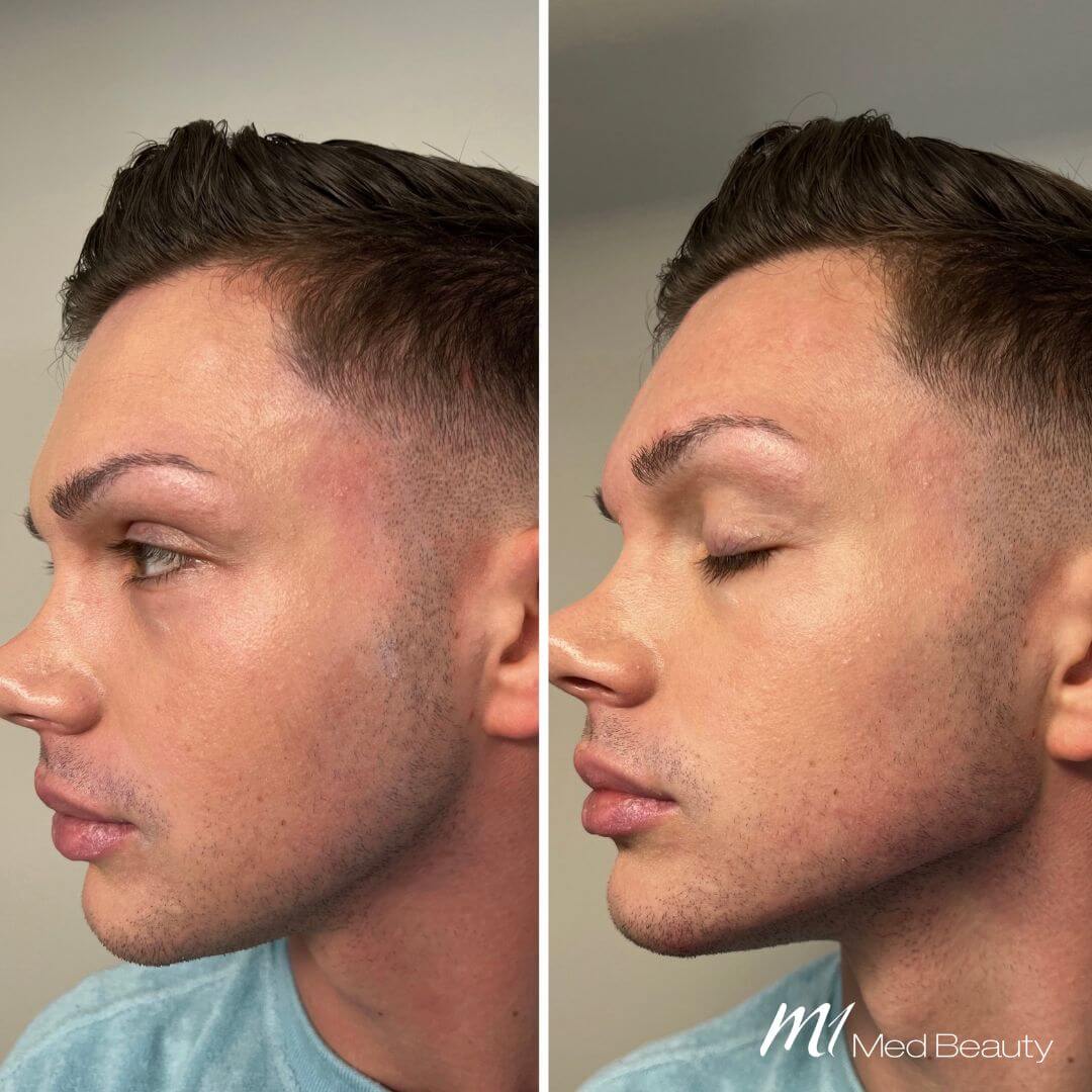 Jawline (2)