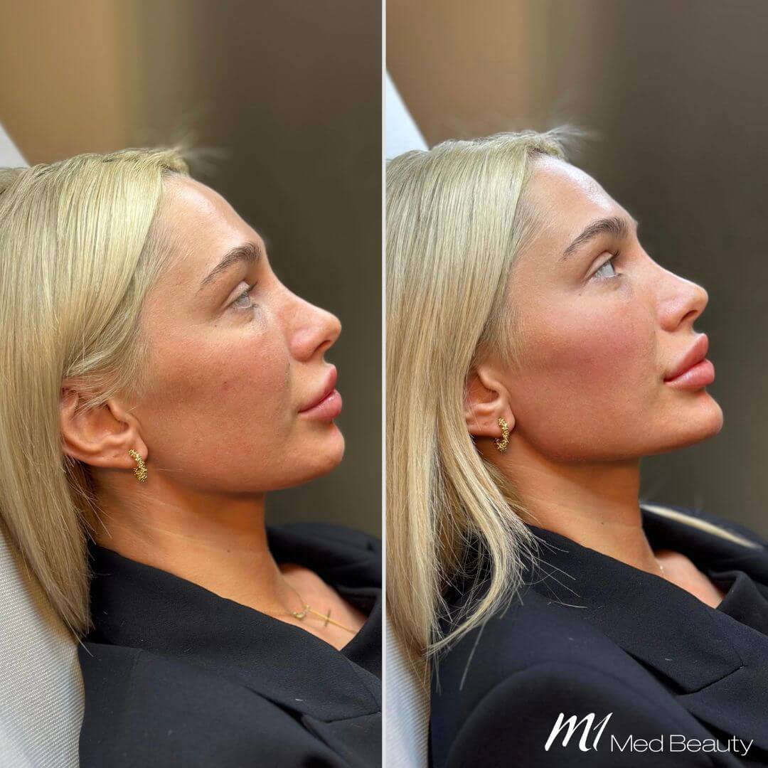 Jawline