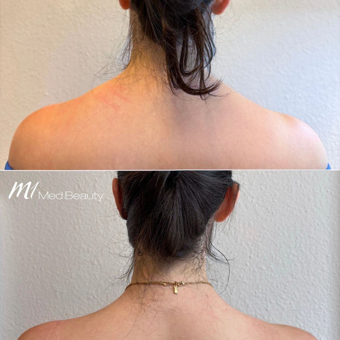Neck (1)